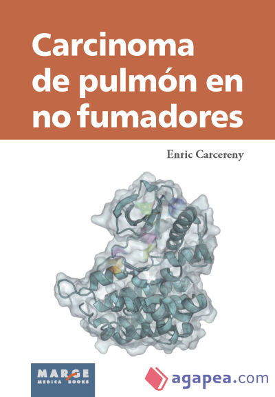 CARCINOMA DE PULMÓN EN NO FUMADORES