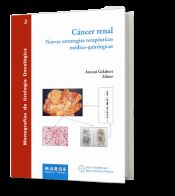 Portada de Cáncer renal. Nuevas estrategias terapeuticas medico-quirurgicas