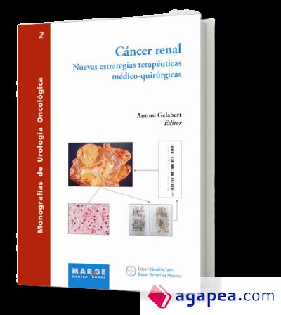 Cáncer renal. Nuevas estrategias terapeuticas medico-quirurgicas Cáncer renal. Nuevas estrategias terapeuticas medico-quirurgicas