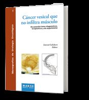 Portada de Cáncer vesical que no infiltra músculo