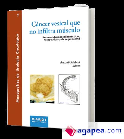 Cáncer vesical que no infiltra músculo