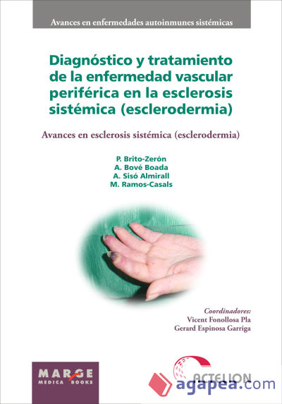 Diagnóstico y tratamiento de la enfermedad vascular periférica en la esclerosis sistémica (esclerodermia)