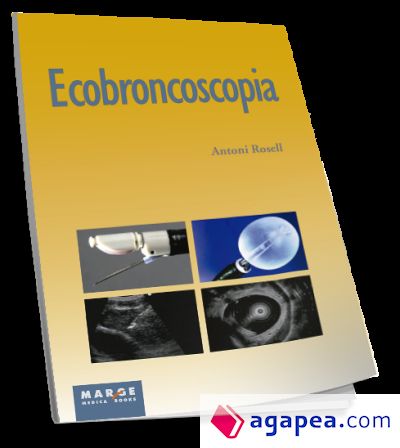 ECOBRONCOSCOPIA