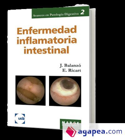 Enfermedad inflamatoria intestinal