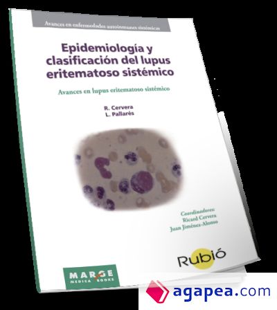 Epidemiología y clasificación del lupus eritematoso sistémico