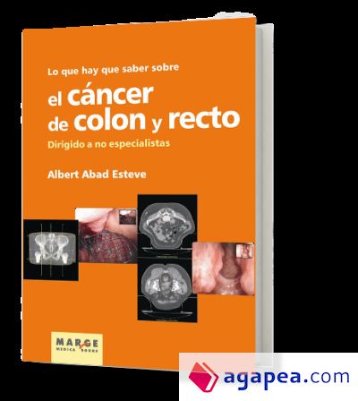 Lo que hay que saber sobre el cáncer de colon y recto