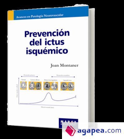 Prevención del ictus isquémico Prevención del ictus isquémico