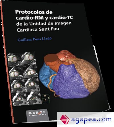 Protocolos de cardio-RM y cardio-TC de la Unidad de Imagen Cardiaca Sant Pau