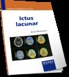 Ictus lacunar