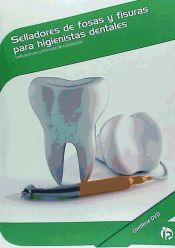 Portada de Selladores de fosas y fisuras para higienistas dentales : indicaciones y técnicas de colocación