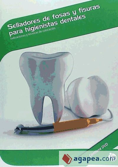 Selladores de fosas y fisuras para higienistas dentales : indicaciones y t&eacute;cnicas de colocaci&oacute;n