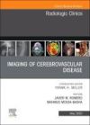 Imaging of Cerebrovascular Disease, an Issue of Radiologic Clinics of North America: Volume 61-3