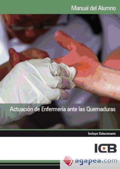 Manual Actuación de Enfermería ante las Quemaduras