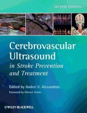 Portada de Cerebrovascular Ultrasound in Stroke Prevention and Treatment