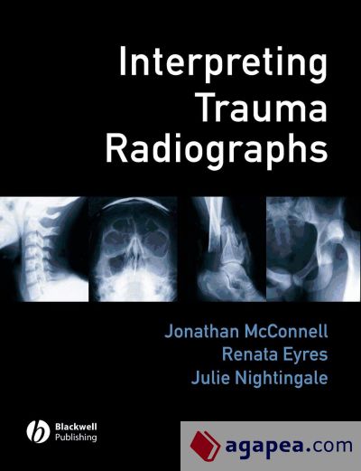 Interpreting Trauma Radiographs