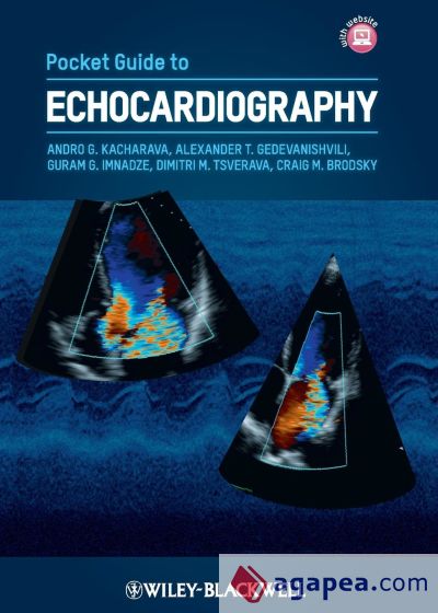 Pocket Guide to Echocardiograp