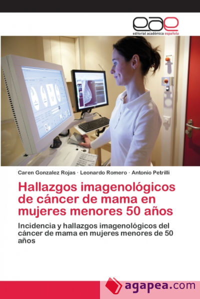 Hallazgos imagenológicos de cáncer de mama en mujeres menores 50 años