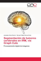 Portada de Segmentación de tumores cerebrales en IRM, vía Graph Cuts