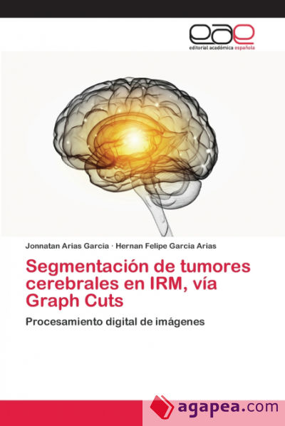 Segmentación de tumores cerebrales en IRM, vía Graph Cuts
