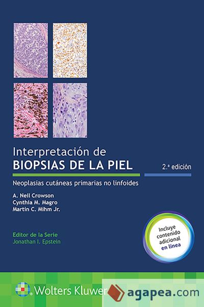 Interpretacion De Biopsias De La Piel. Neoplasias Cut&aacute;neas Primarias No Linfoides