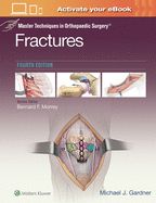 Portada de Master Techniques in Orthopaedic Surgery: Fractures
