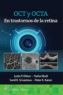 Portada de OCT Y OCTA EN TRASTORNOS DE LA RETINA