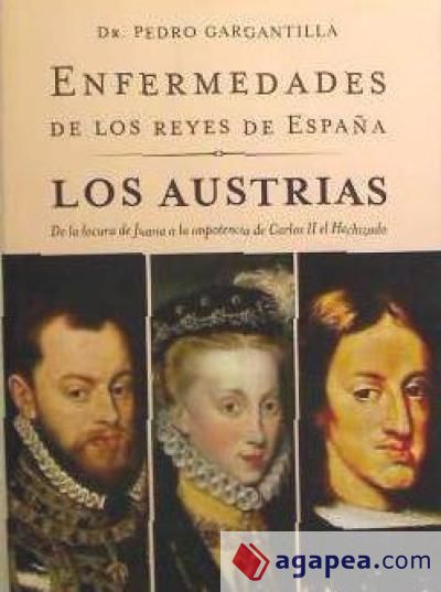 Enfermedades de los reyes de España. Los Austrias