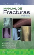 Portada de Manual De Fracturas