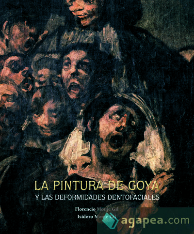 La pintura de Goya y las deformidades dentofaciales