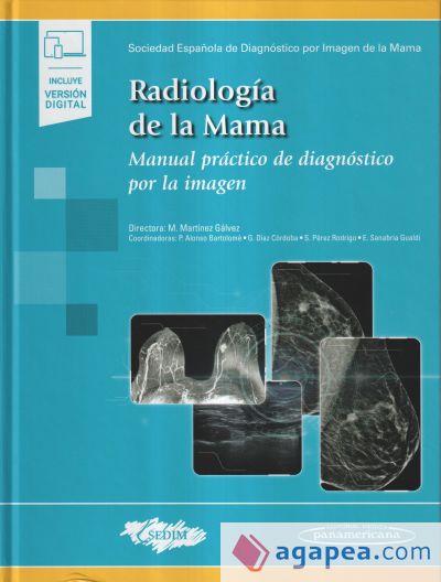 Tratado De Radiologia De La Mama Aavv 9788491105534 2937