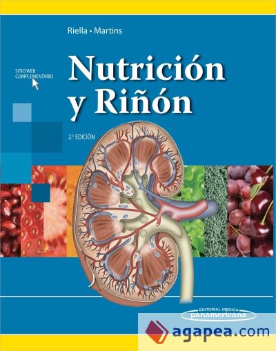 Nutrición y riñón