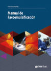 Manual de facoemulsificación