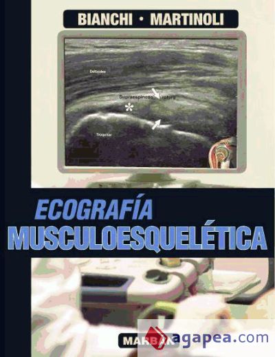 Ecografía Musculoesquelética