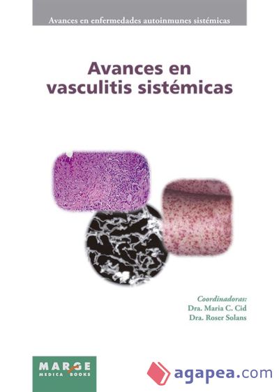 Avances en vasculitis sistémicas (Ebook)