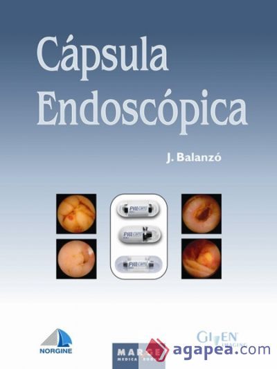 C&aacute;psula endosc&oacute;pica (Ebook)