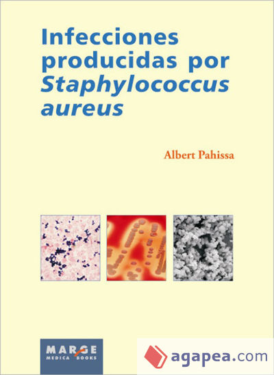 Infecciones producidas por Staphylococcus aureus (Ebook)