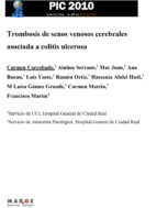 Portada de Trombosis de senos venosos cerebrales asociada a colitis ulcerosa (Ebook)