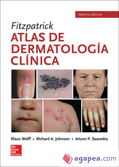 Fitzpatrick atlas visual de dermatología
