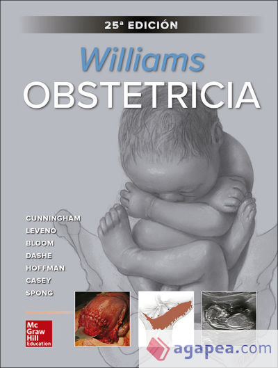 WILLIAMS OBSTETRICIA