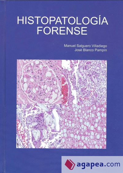 Histopatología Forense