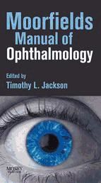 Portada de E-Book - Moorfields Manual of Ophthalmology (Ebook)