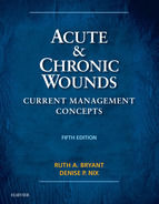 Portada de Acute and Chronic Wounds - E-Book (Ebook)