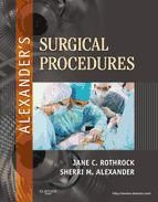 Portada de Alexander's Surgical Procedures - E-Book (Ebook)