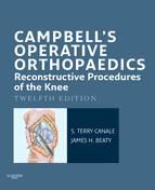 Portada de Campbell's Operative Orthopaedics: Reconstructive Procedures of the Knee E-Book (Ebook)