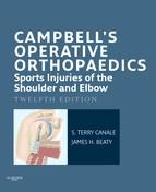 Portada de Campbell's Operative Orthopaedics: Sports Injuries of the Shoulder and Elbow E-Book (Ebook)