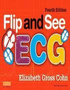 Portada de Flip and See ECG - E-Book (Ebook)