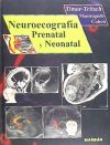 Neuroecografía Prenatal Y Neonatal