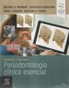 Newman y Carranza. Periodontología clínica esencial