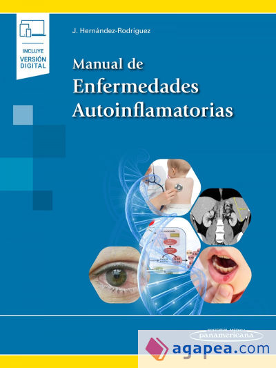 ENFERMEDADES AUTOINFLAMATORIAS