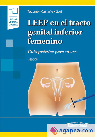 LEEP en el tracto genital inferior femenino. . Guía práctica para su uso. (Incluye versión digital)